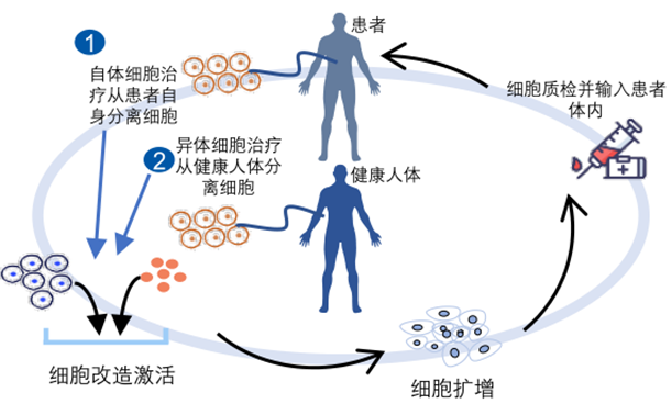 自体与异体细胞疗法示例