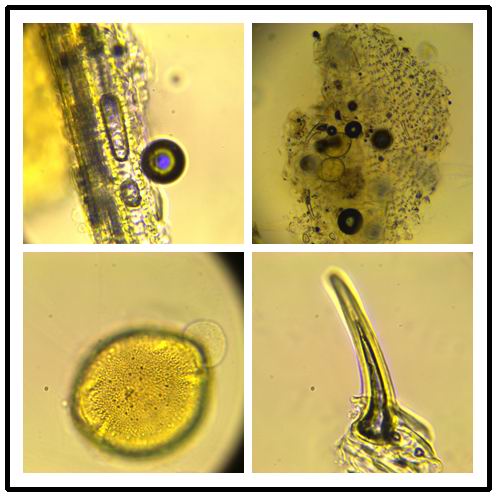 Honeysuckle - Lonicera japonica (microscopic observation)